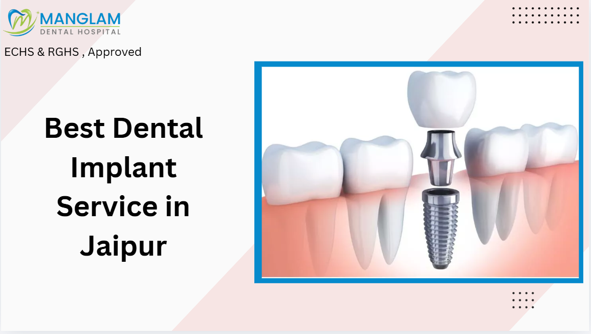 Dental Implant Service in Jaipur with rghs and cghs